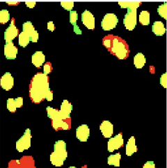 cell segmentation thumbnail